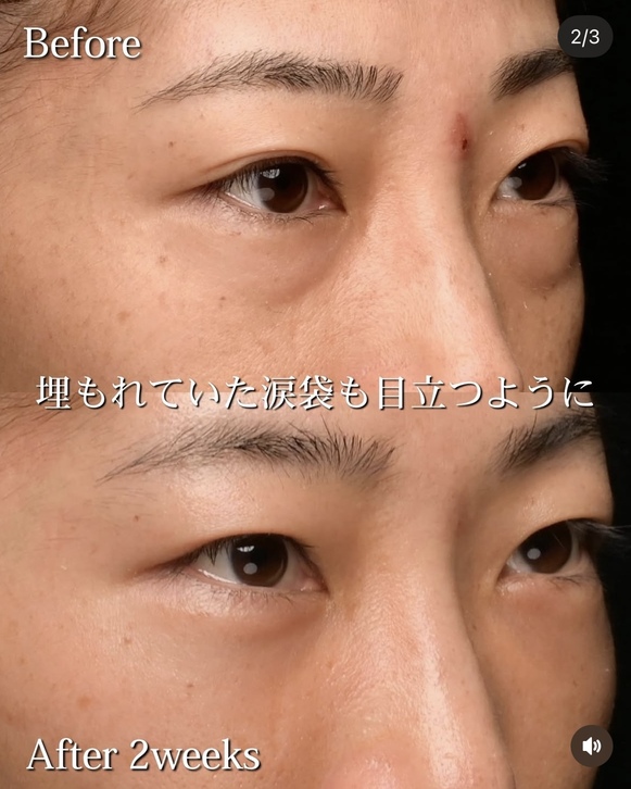 症例写真