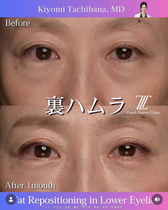 症例写真