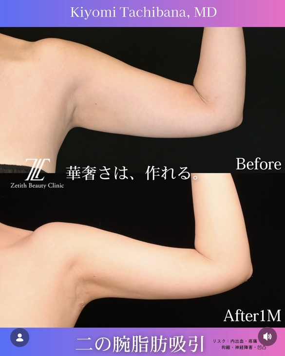 症例写真