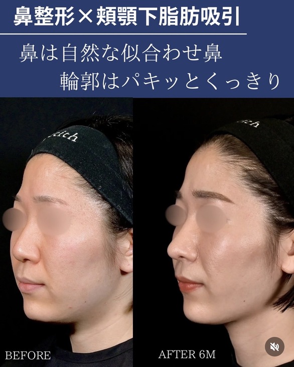 症例写真