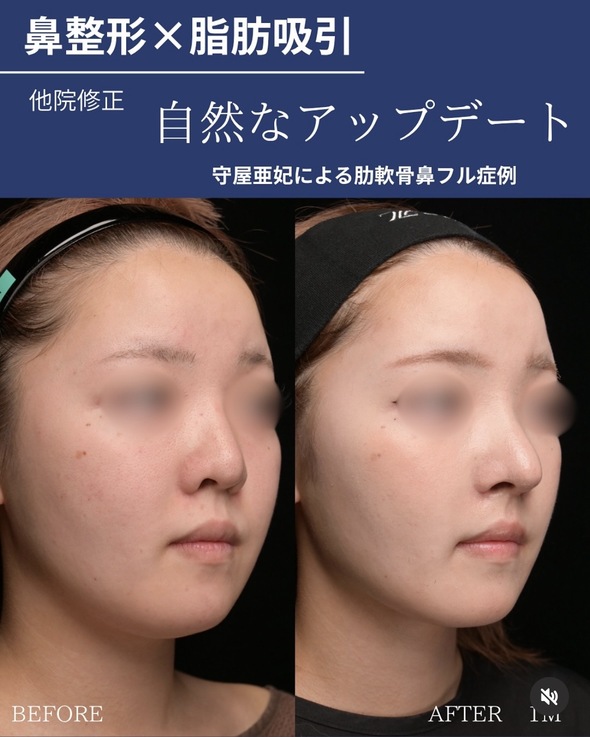 症例写真1
