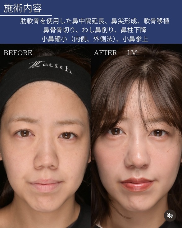 症例写真1