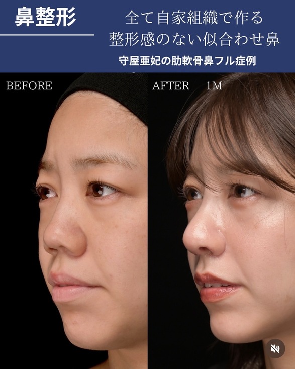 症例写真2