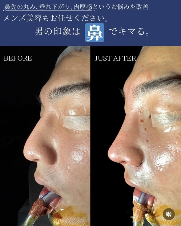 症例写真1