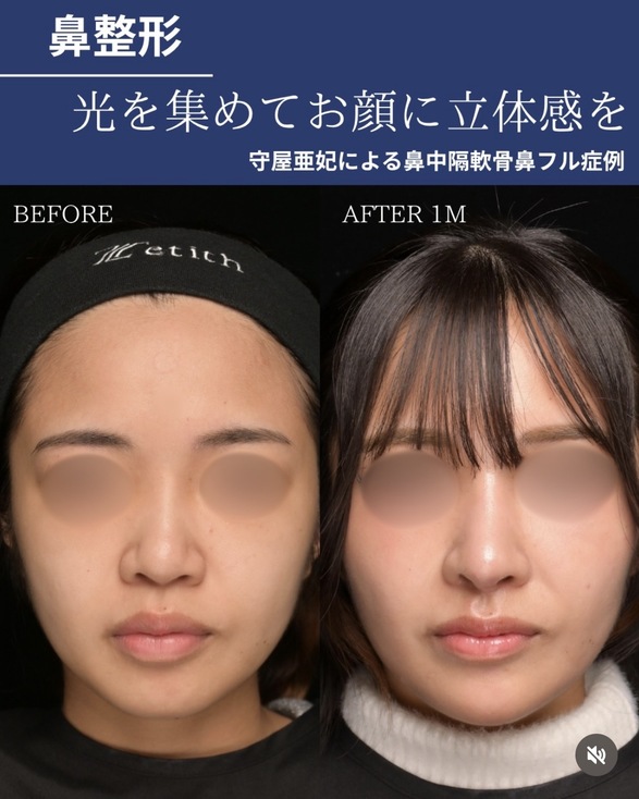 症例写真1