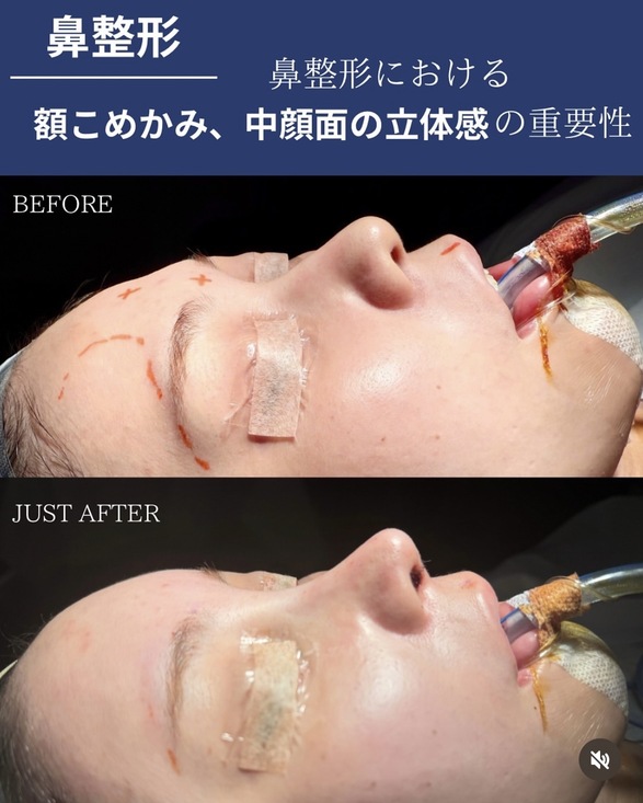 症例写真1