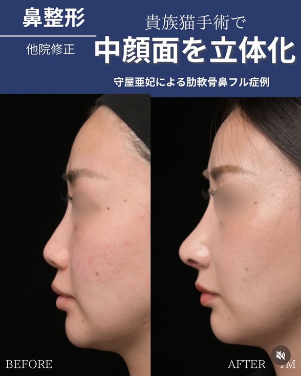 症例写真1