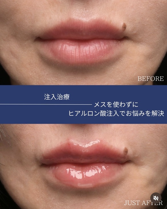症例写真1
