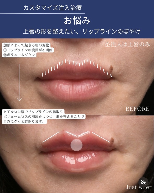 症例写真2