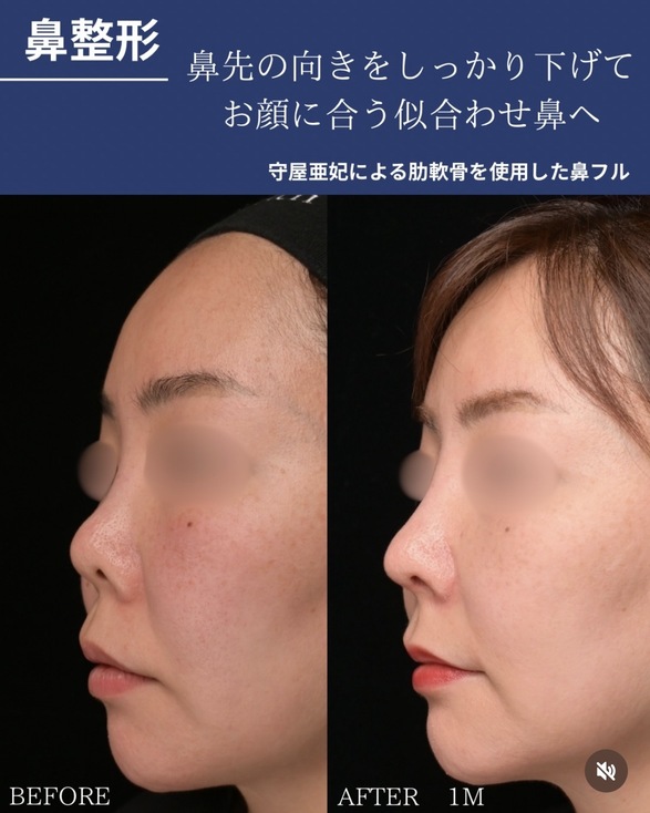 症例写真2