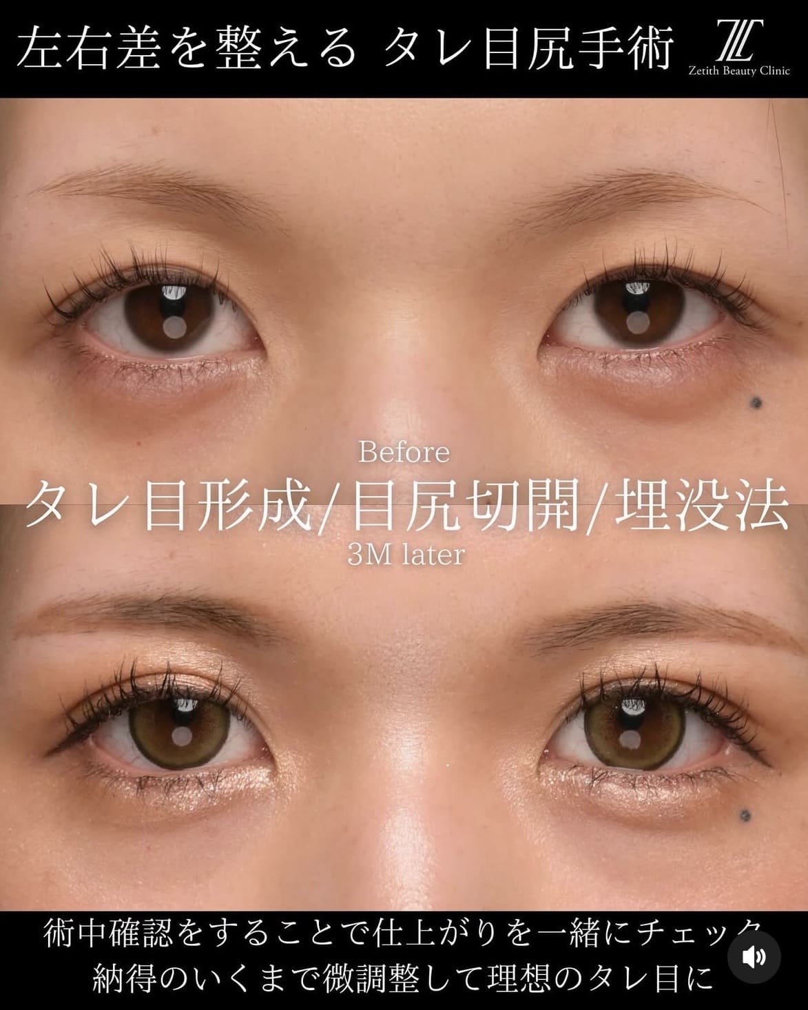 症例写真1
