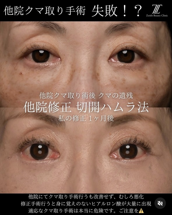 症例写真1