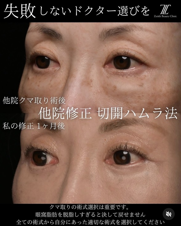 症例写真2