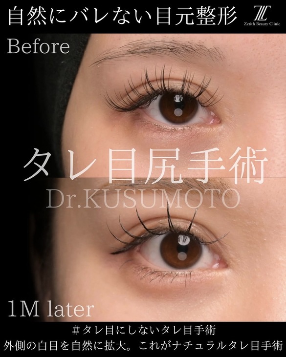 症例写真2