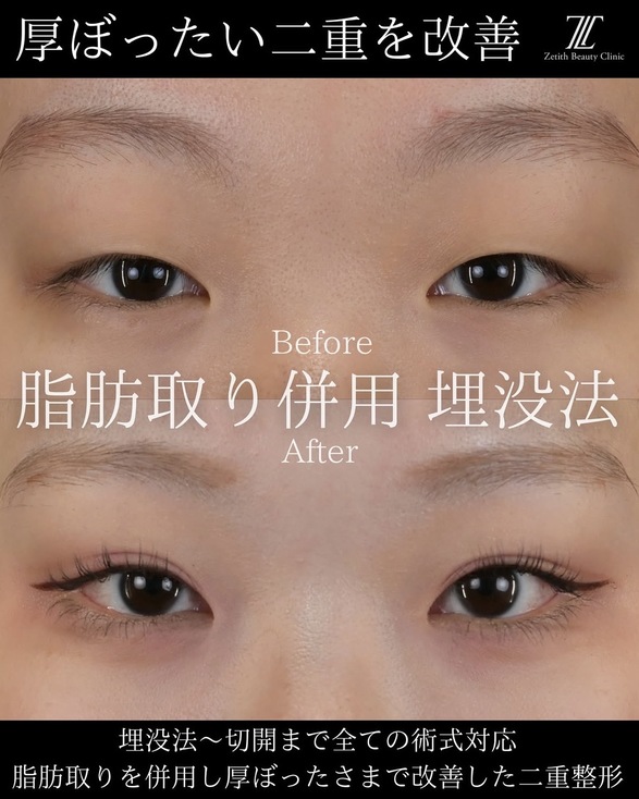 症例写真1