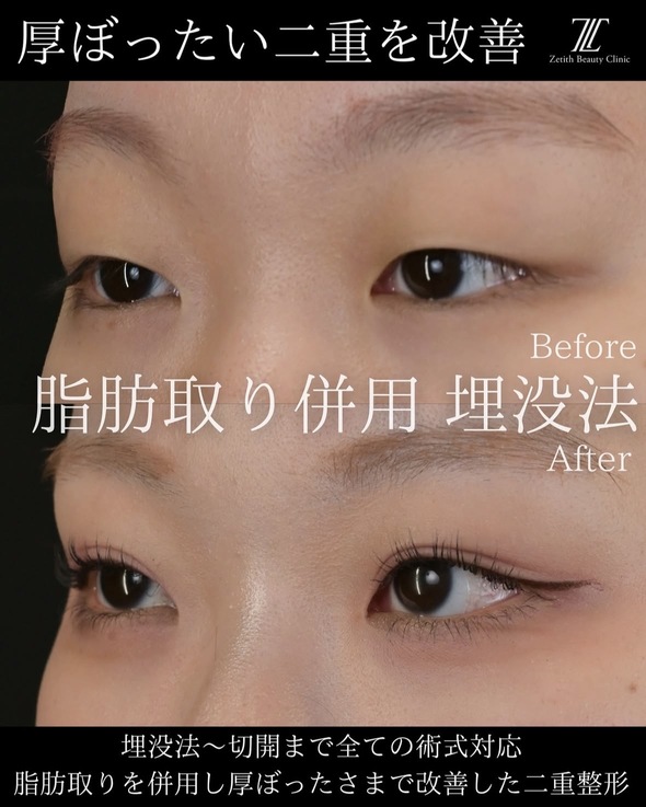 症例写真2