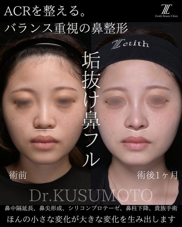 症例写真1