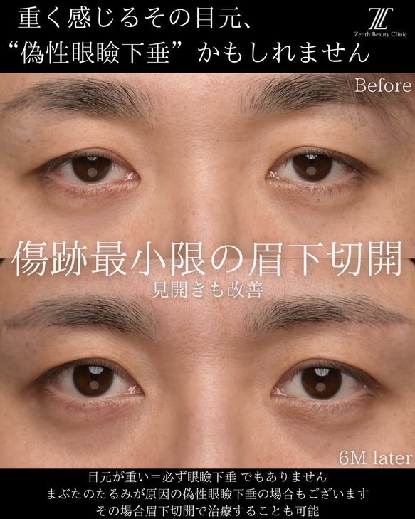 症例写真1