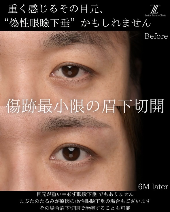 症例写真2