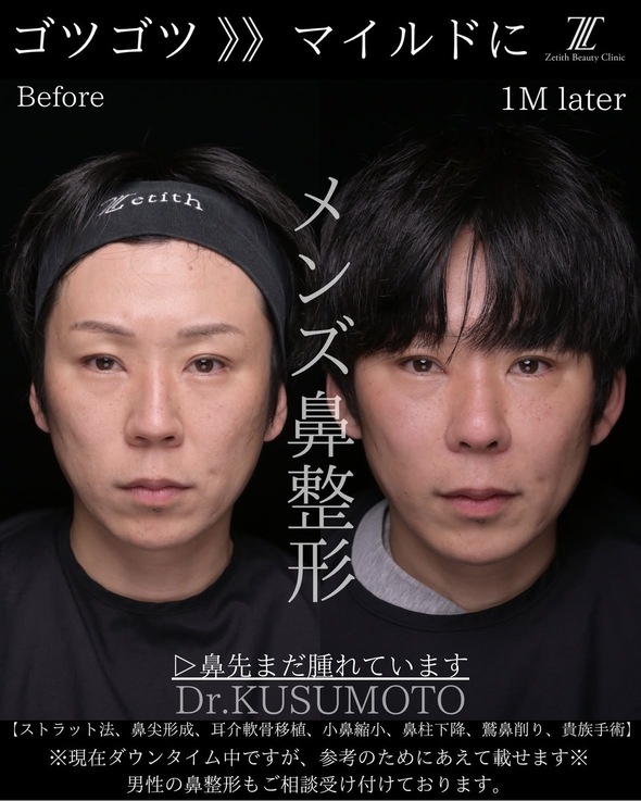 症例写真1