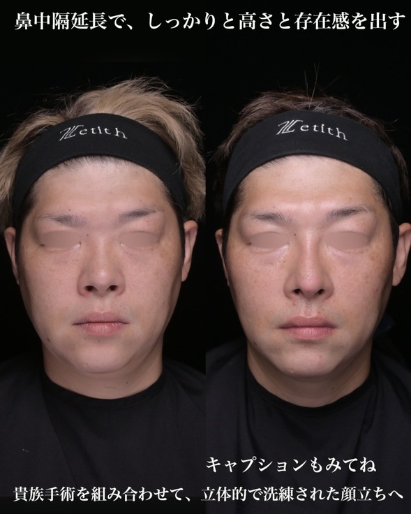 症例写真1