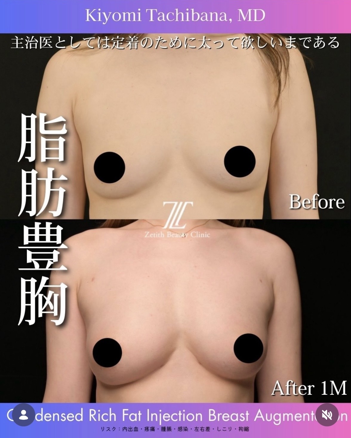 症例写真1