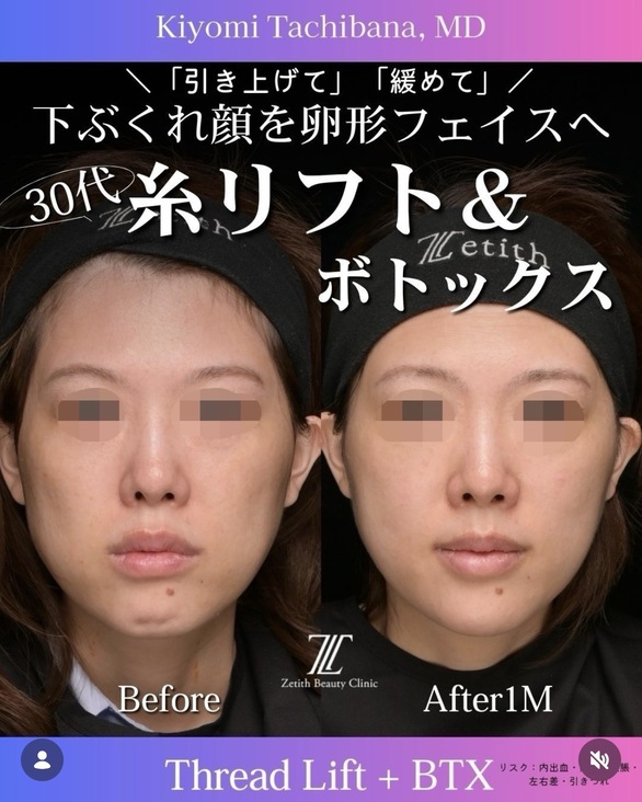 症例写真1