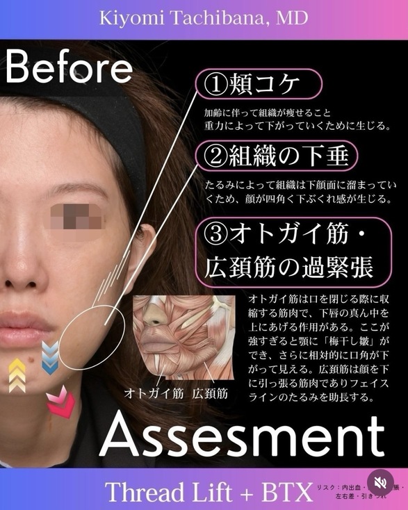 症例写真2