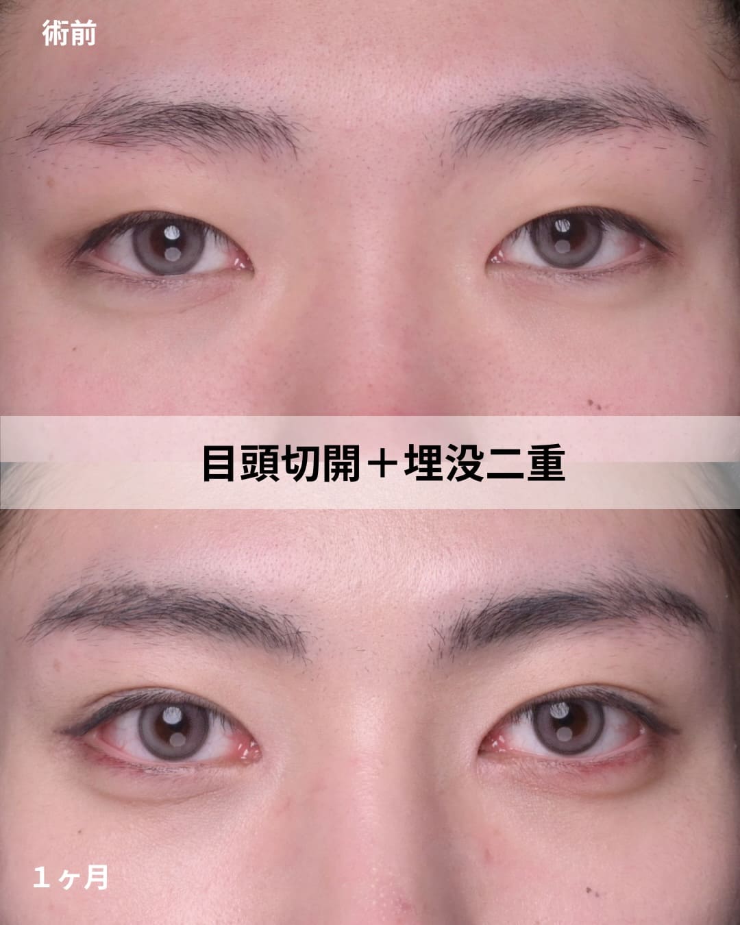 症例写真1