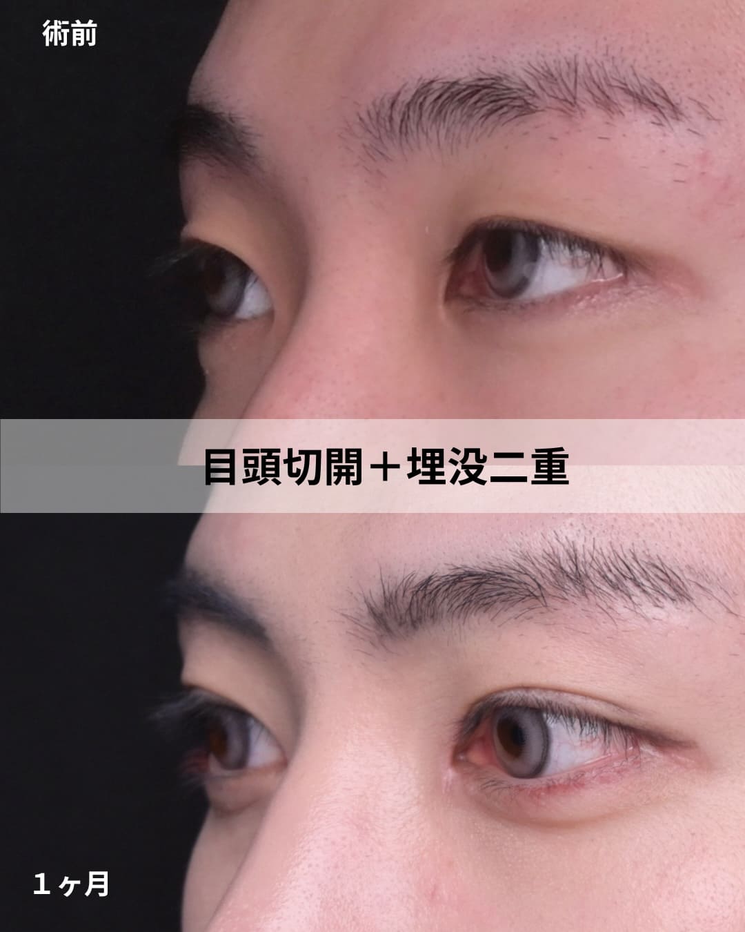 症例写真2
