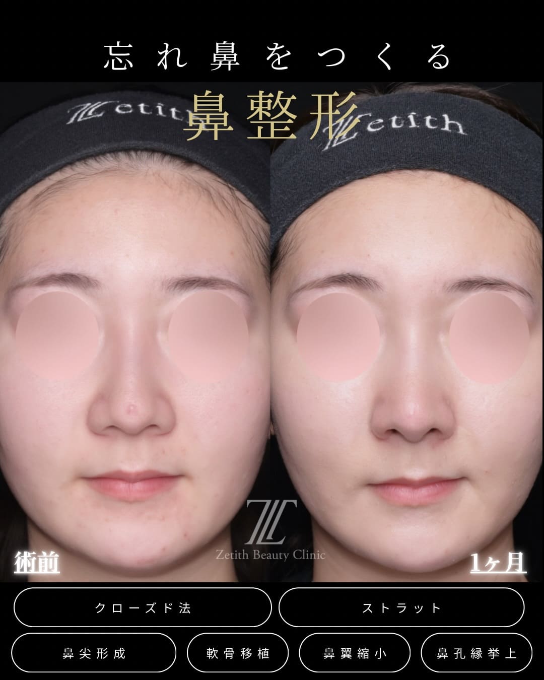 症例写真1