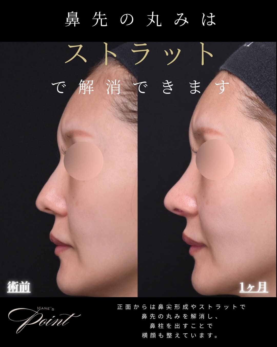症例写真2