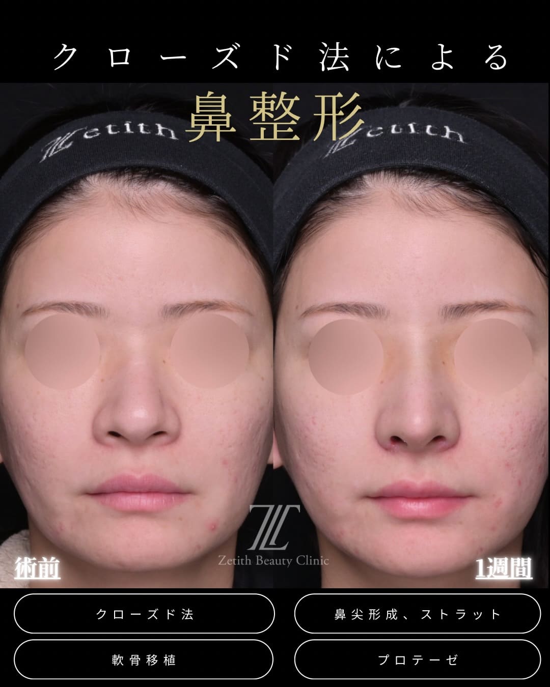 症例写真1