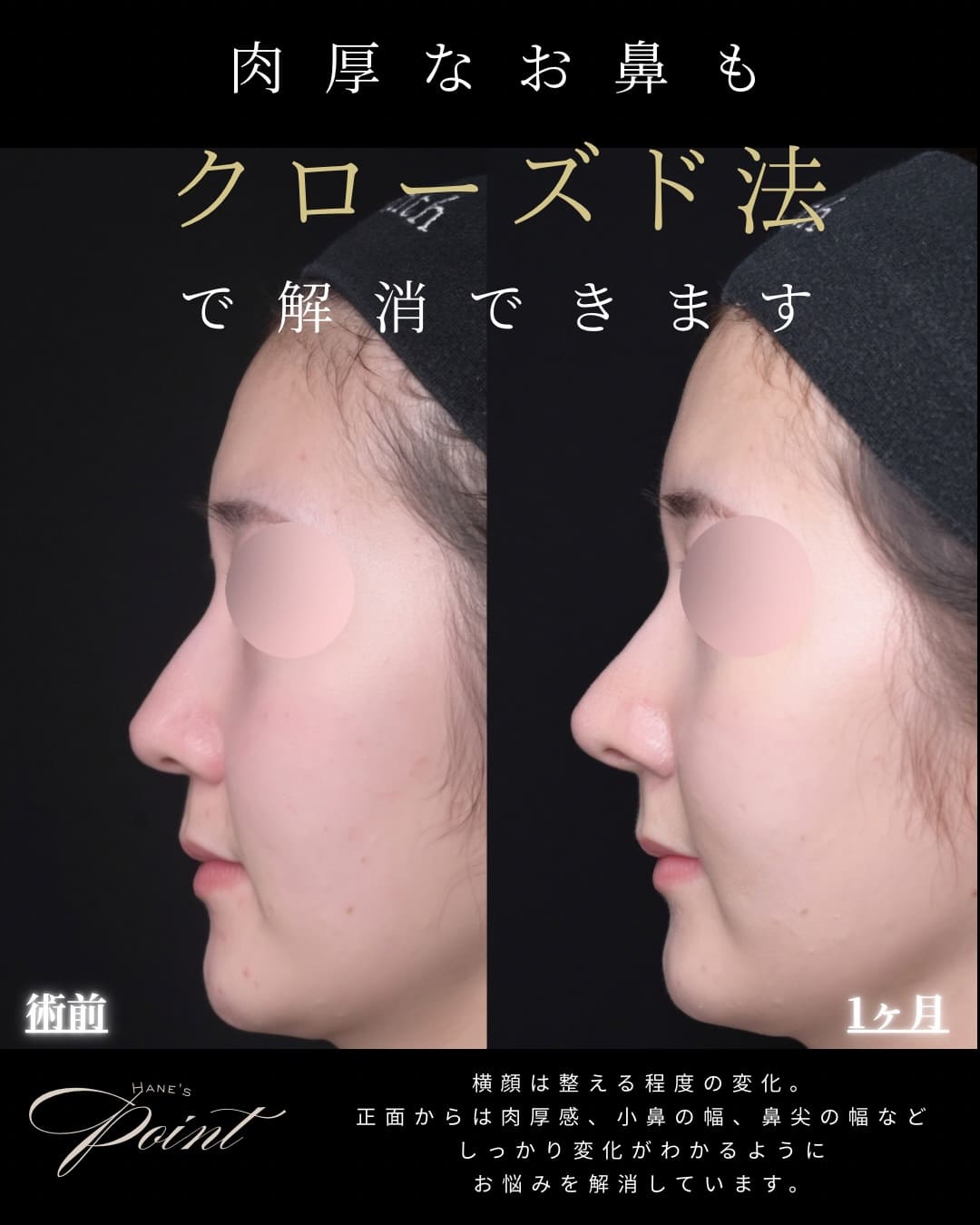 症例写真2