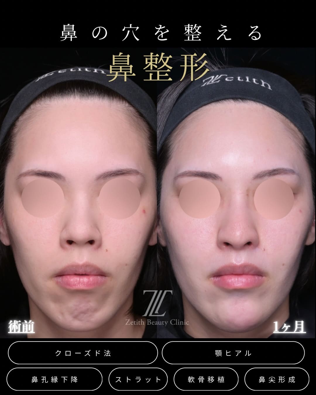 症例写真2