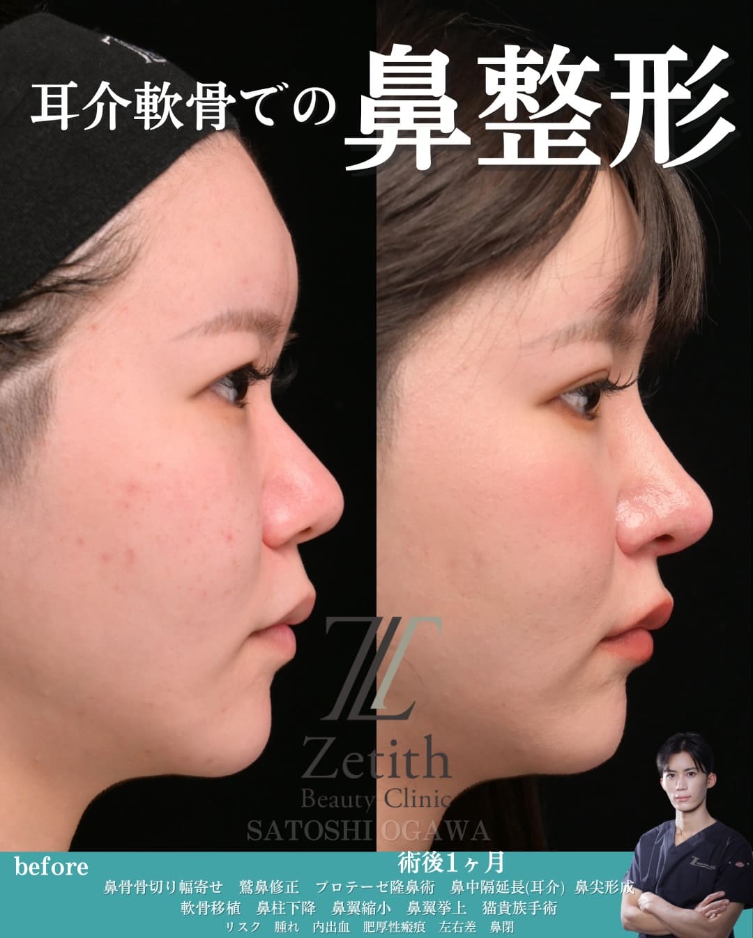 症例写真2