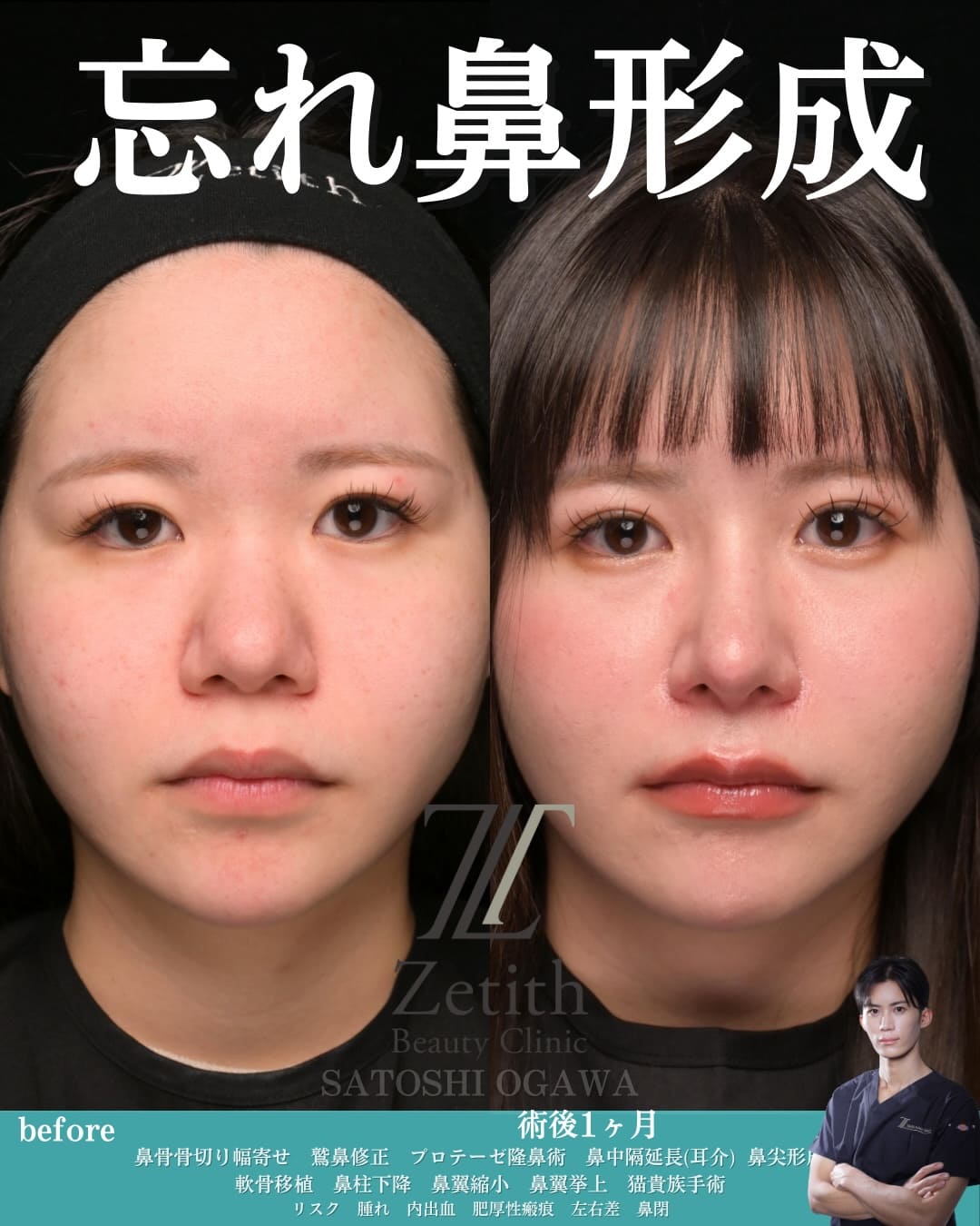 症例写真1