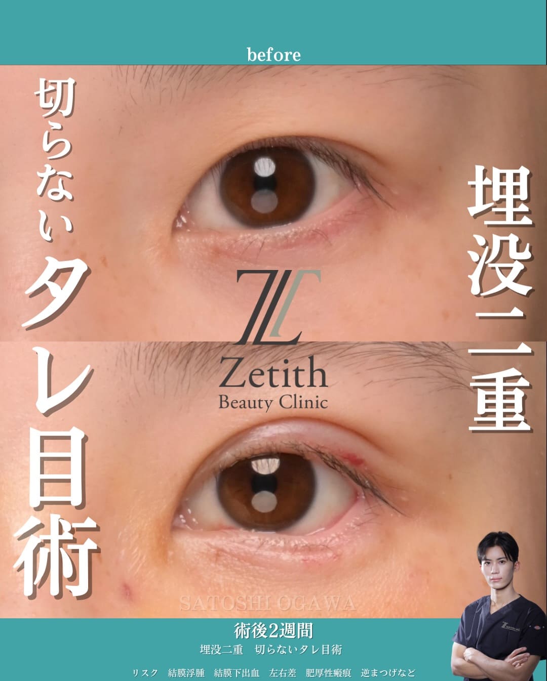 症例写真1