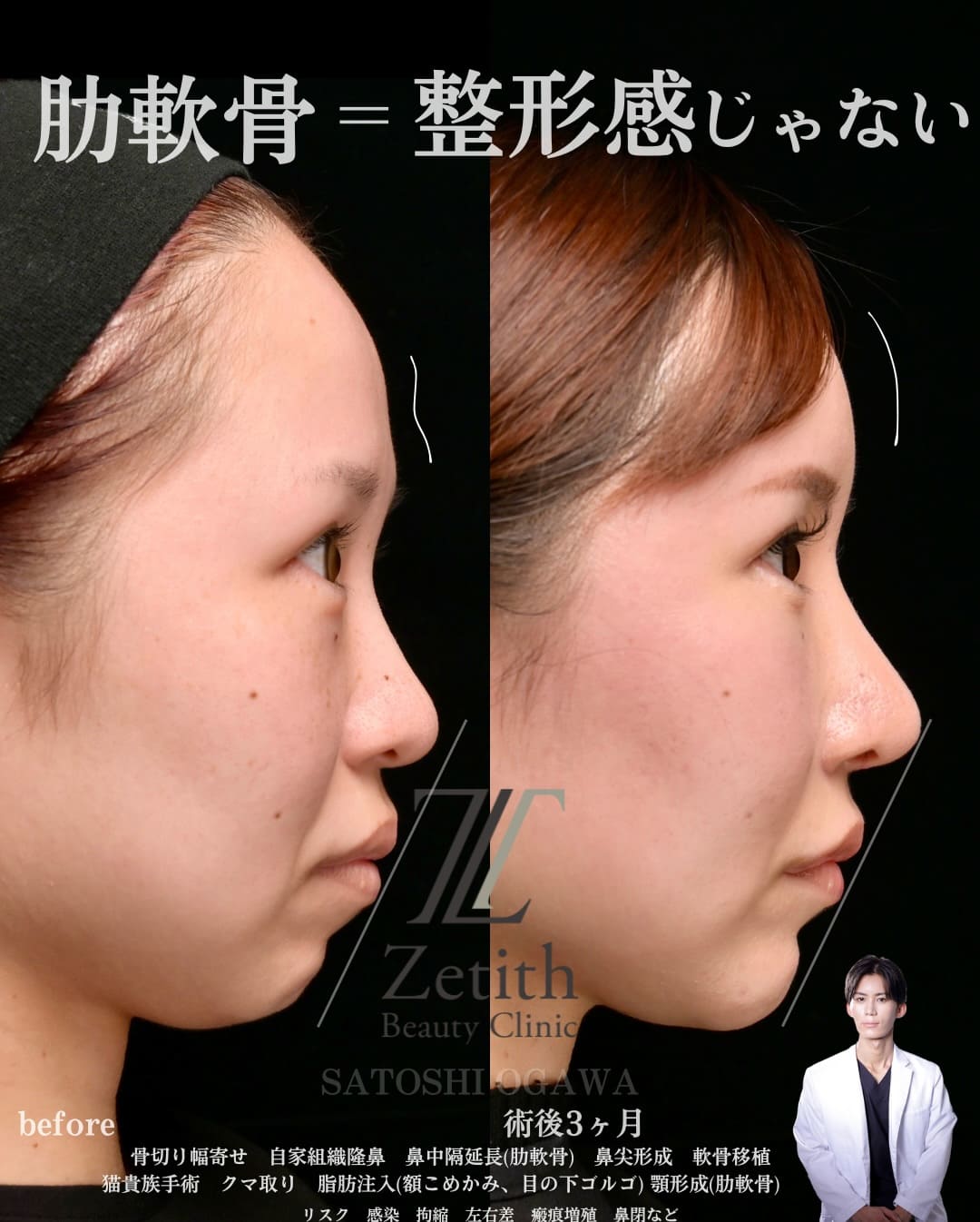 症例写真2