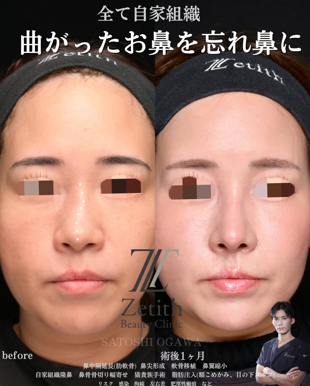 症例写真1