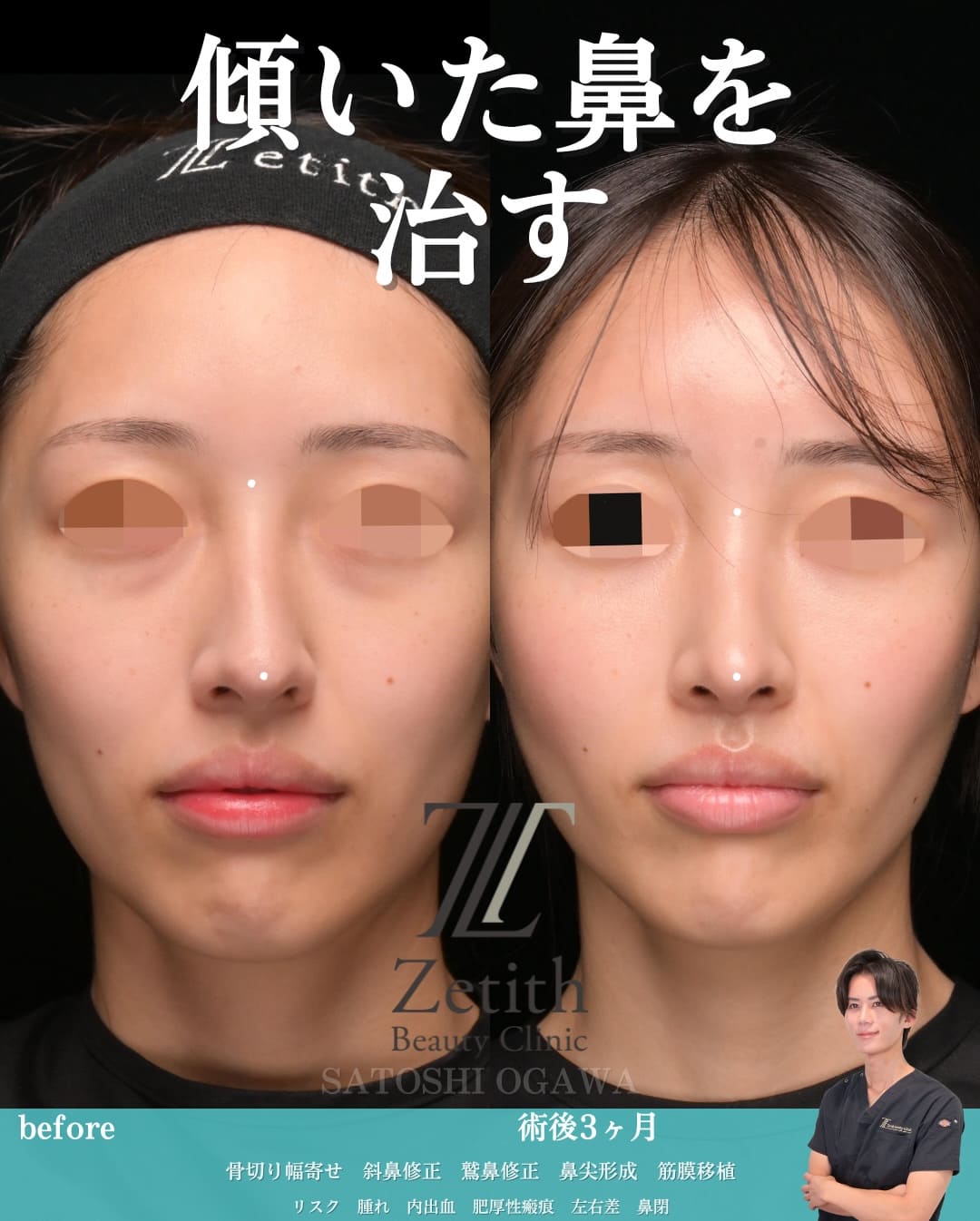 症例写真1
