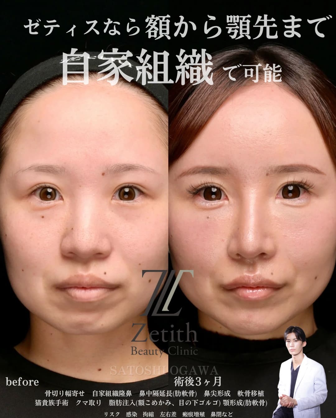 症例写真1