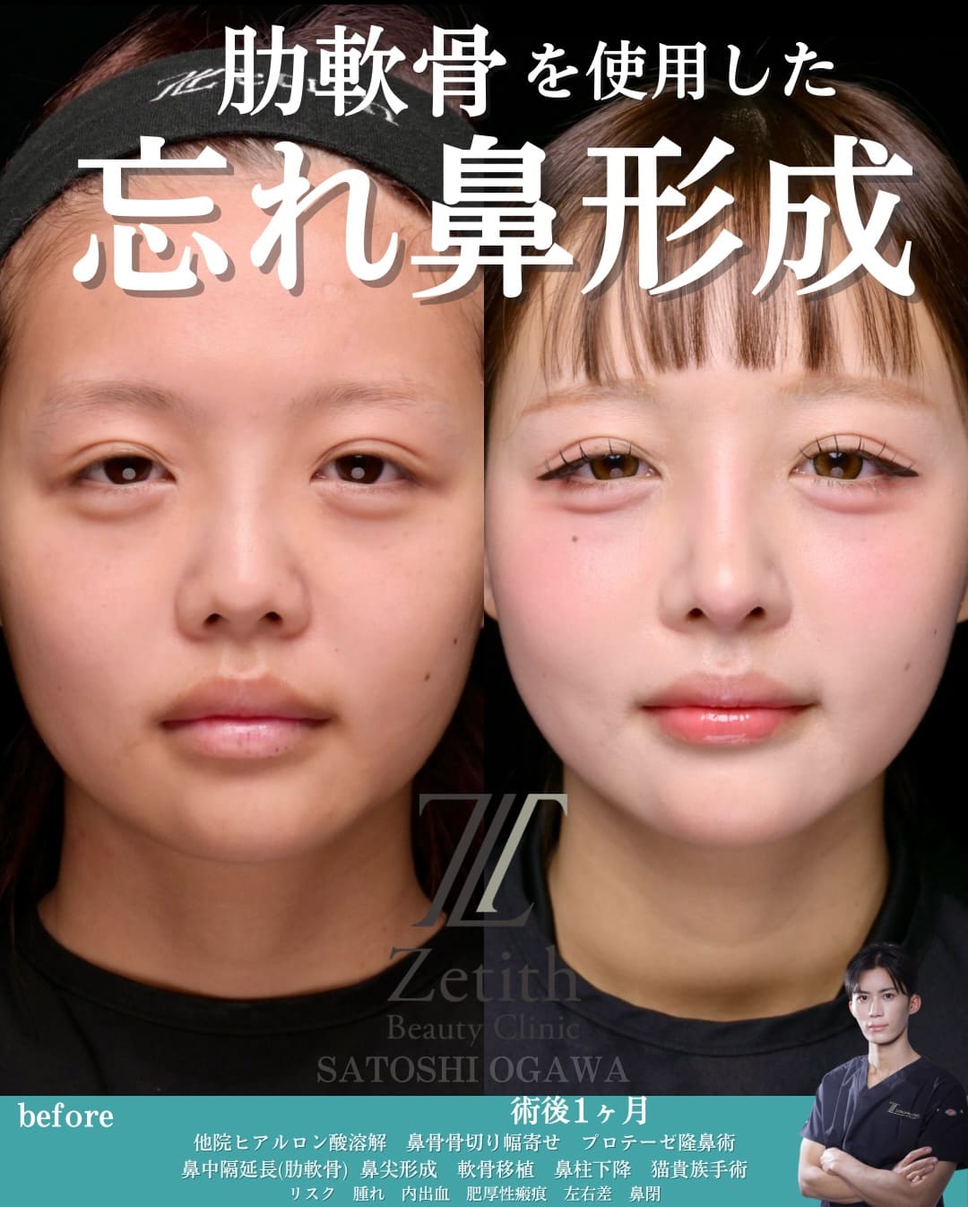 症例写真1