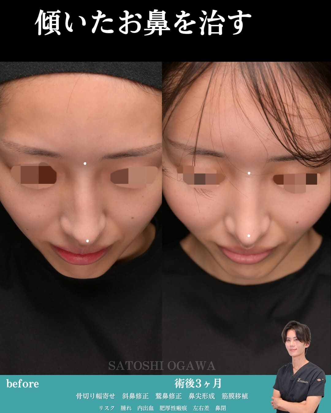 症例写真2