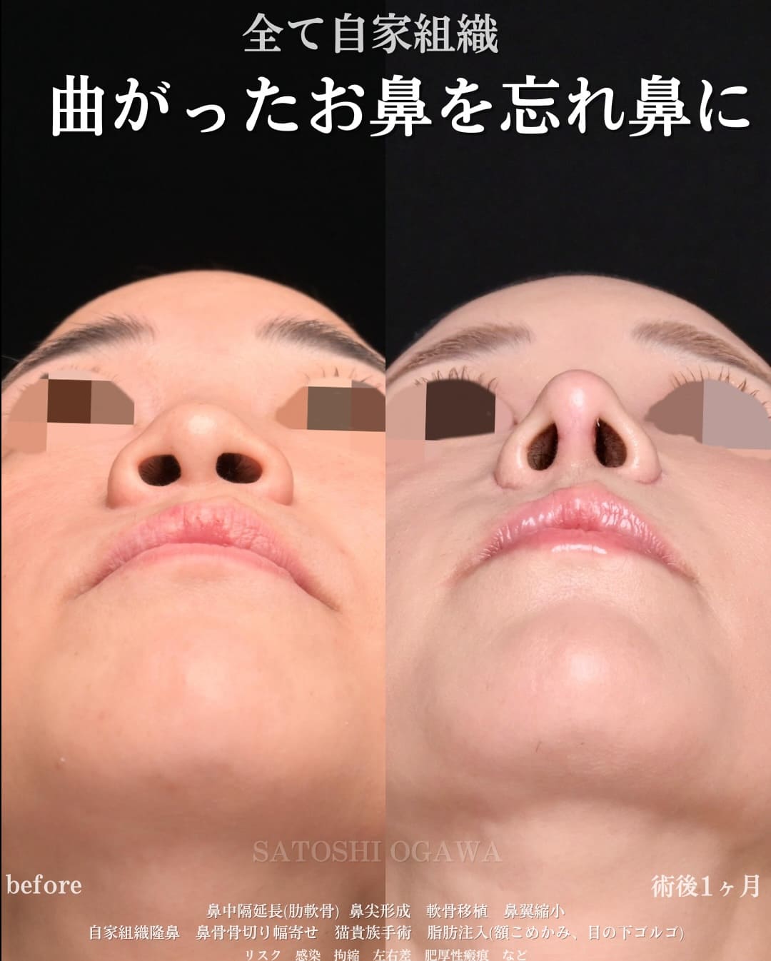 症例写真2