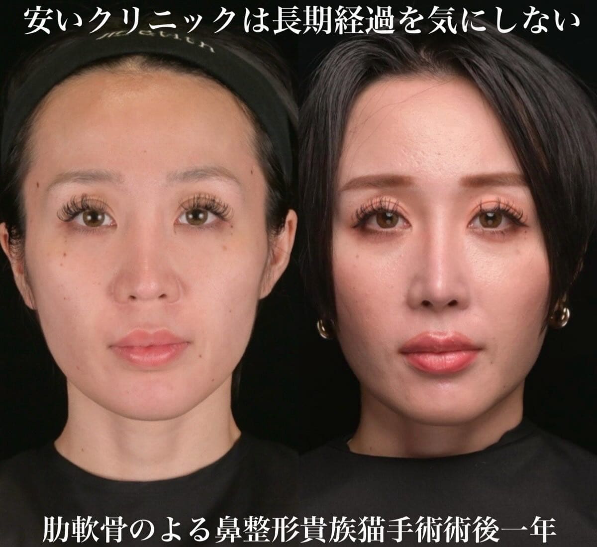 症例写真1