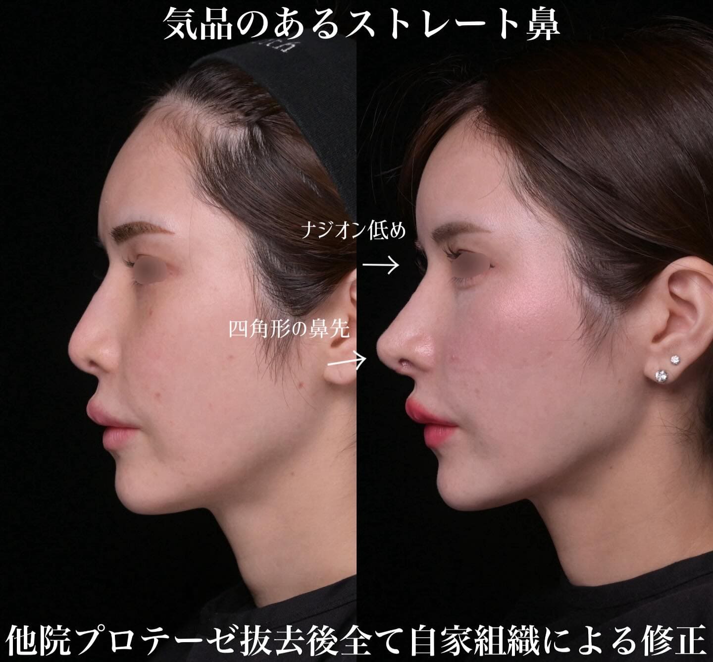 症例写真1