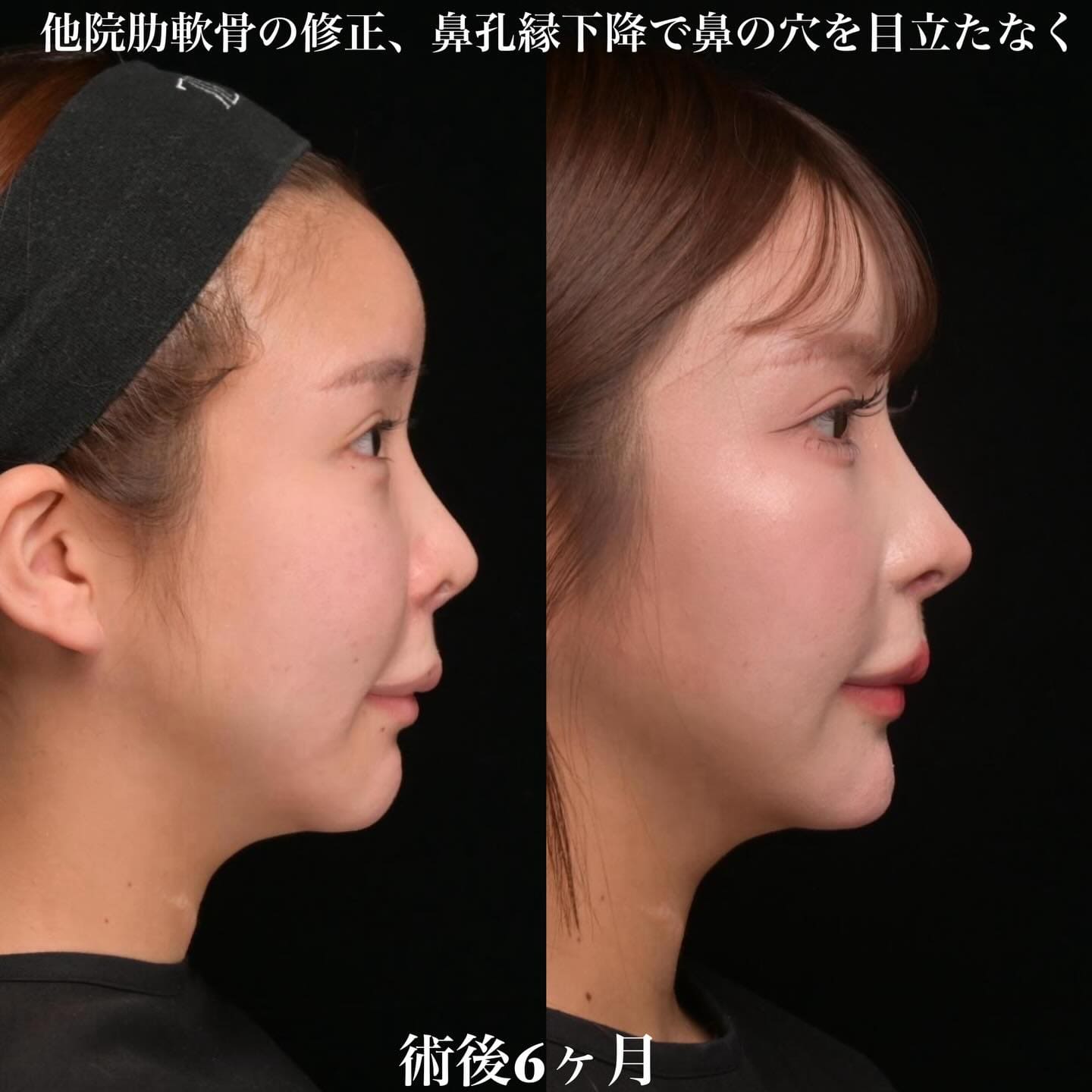 症例写真2