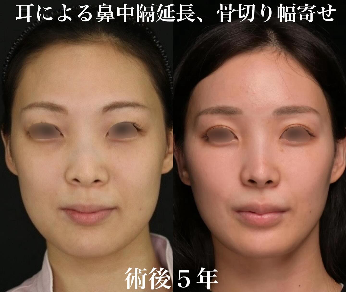 症例写真1