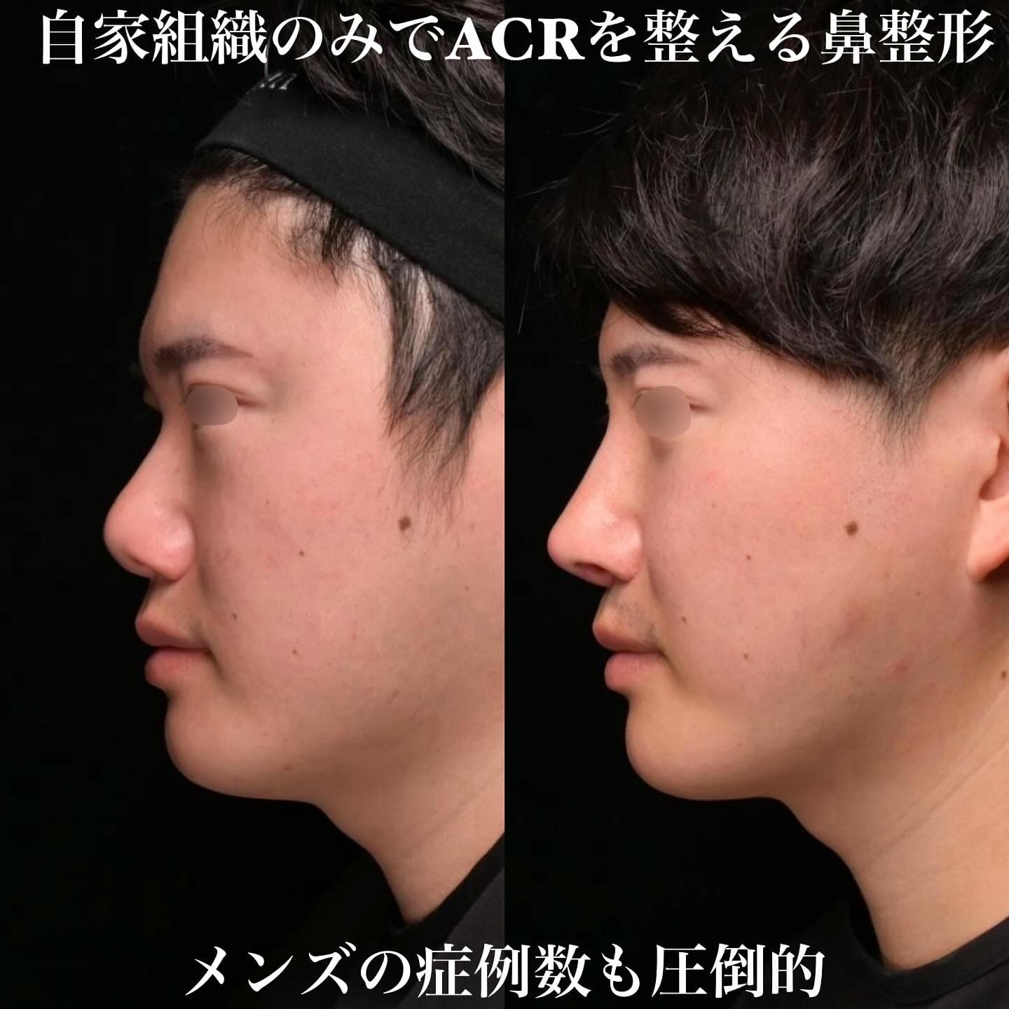 症例写真2